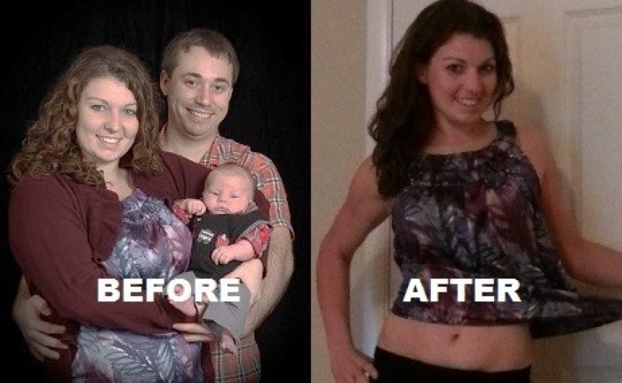 extreme weight loss before after
